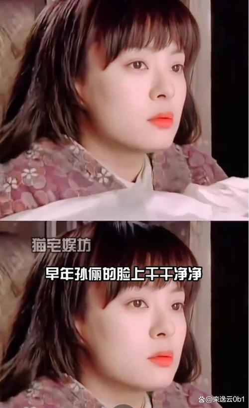 新澳门彩出号综合走势和孙俪唇下痣没了与孙俪嘴唇的痣